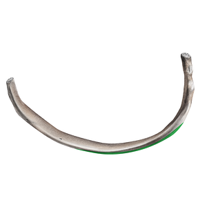 Superior attachment of external intercostal muscle of rib (#21733)