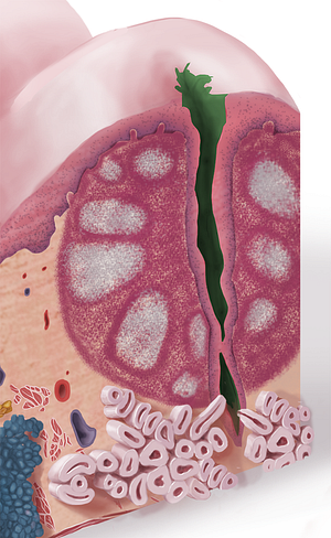 Crypt of lingual tonsil (#3168)