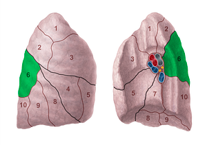 Superior segment of right lung (#20693)