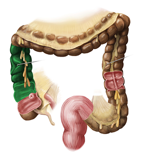 Ascending colon (#2716)