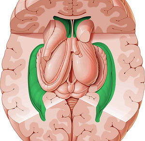 Lateral ventricle (#10710)