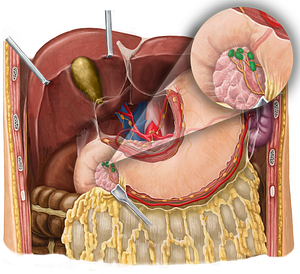 Subpyloric lymph nodes (#7114)