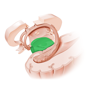 Cerebral peduncle (#19729)