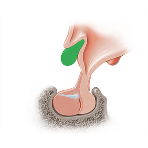 Optic chiasm (#18216)