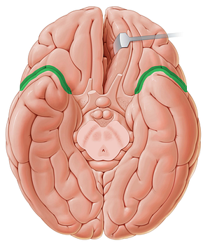Lateral sulcus (#9275)