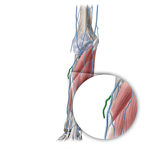 Accessory cephalic vein (#20412)