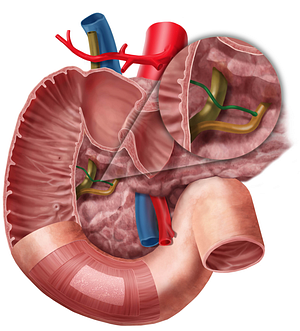 Accessory pancreatic duct (#3337)