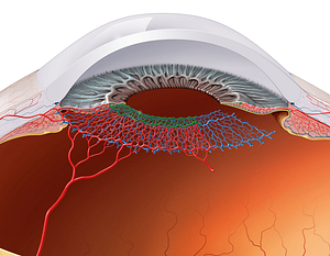 Minor arterial circle of iris (#2626)