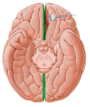 Longitudinal cerebral fissure (#3659)