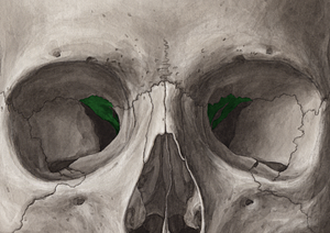 Lesser wing of sphenoid bone (#613)
