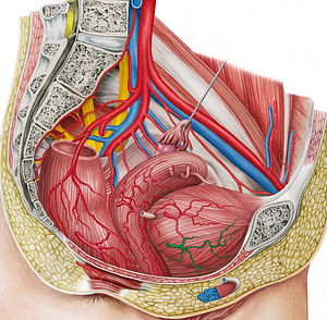 Right inferior vesical artery (#1980)