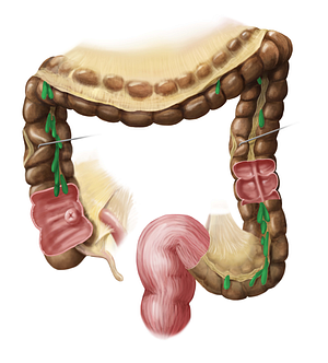 Omental appendices (#787)