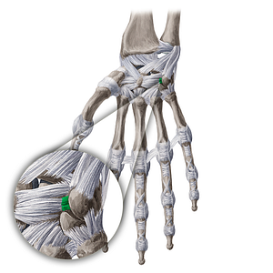 Palmar triquetrohamate ligament (#20660)