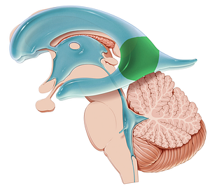 Atrium of lateral ventricle (#9540)
