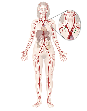 Internal thoracic artery (#1912)