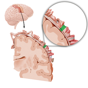 Sensory cortex of face (#11041)