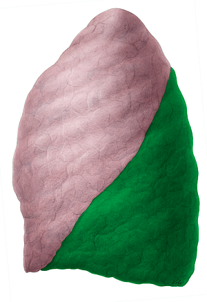 Inferior lobe of left lung (#4817)