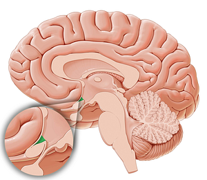 Supraoptic recess (#8860)