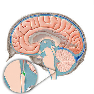 Median aperture of fourth ventricle (#15827)