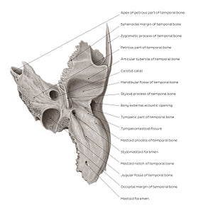Temporal bone (inferior view) (English)