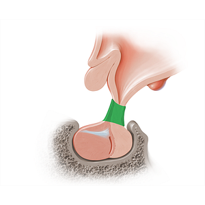 Infundibulum of pituitary gland (#18211)