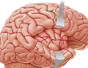 Artery of precentral sulcus (#1849)
