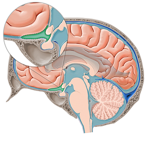 Basal cisterns (#21437)