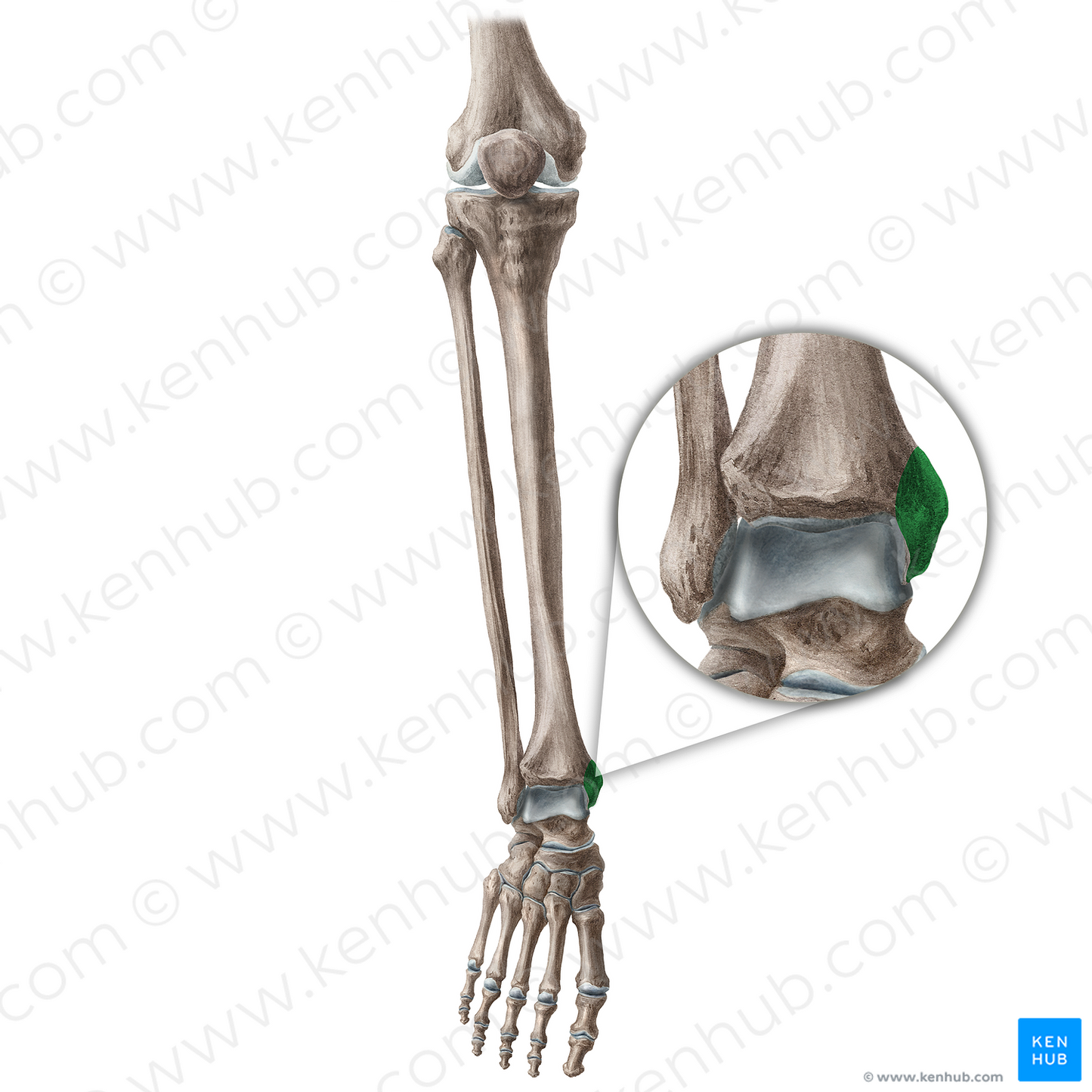 Medial malleolus of tibia (#4892)