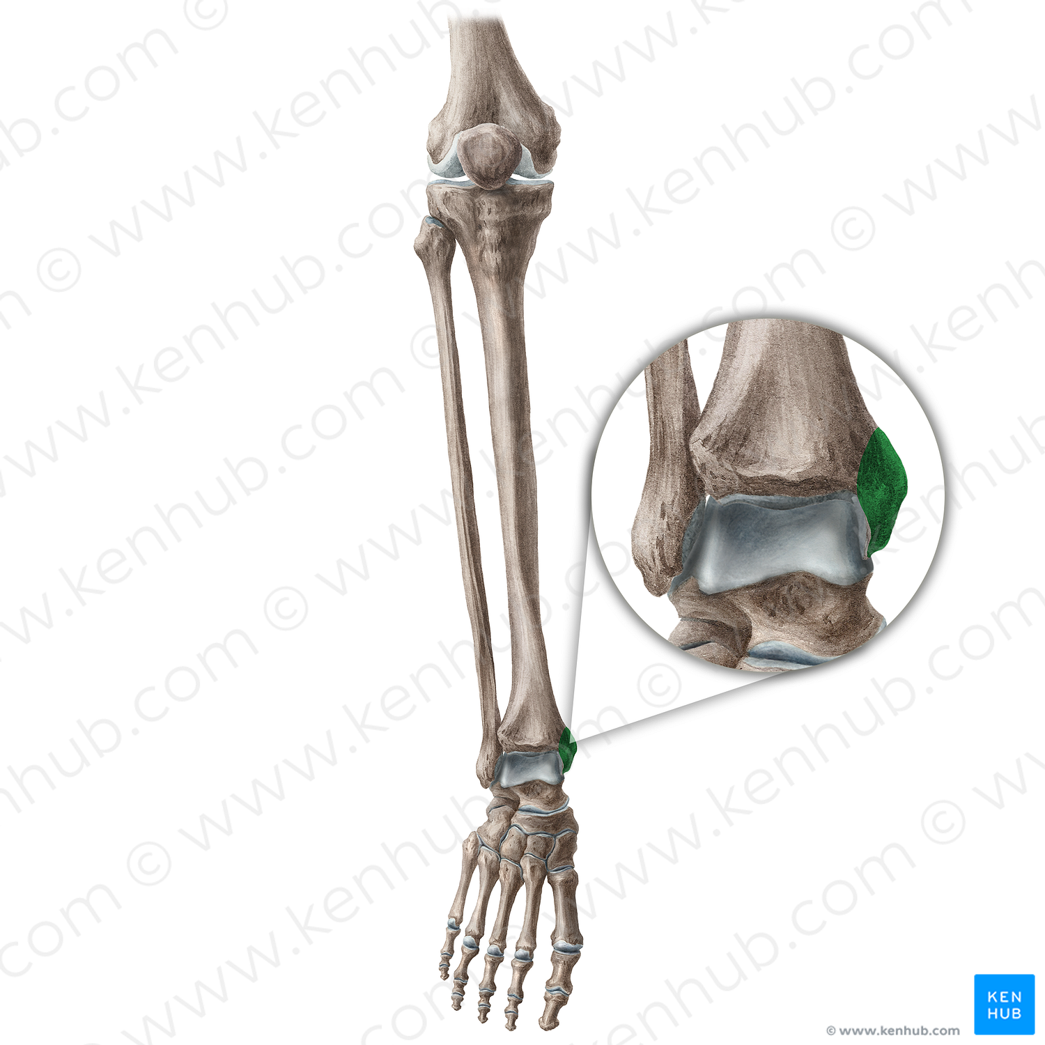 Medial malleolus of tibia (#4892)