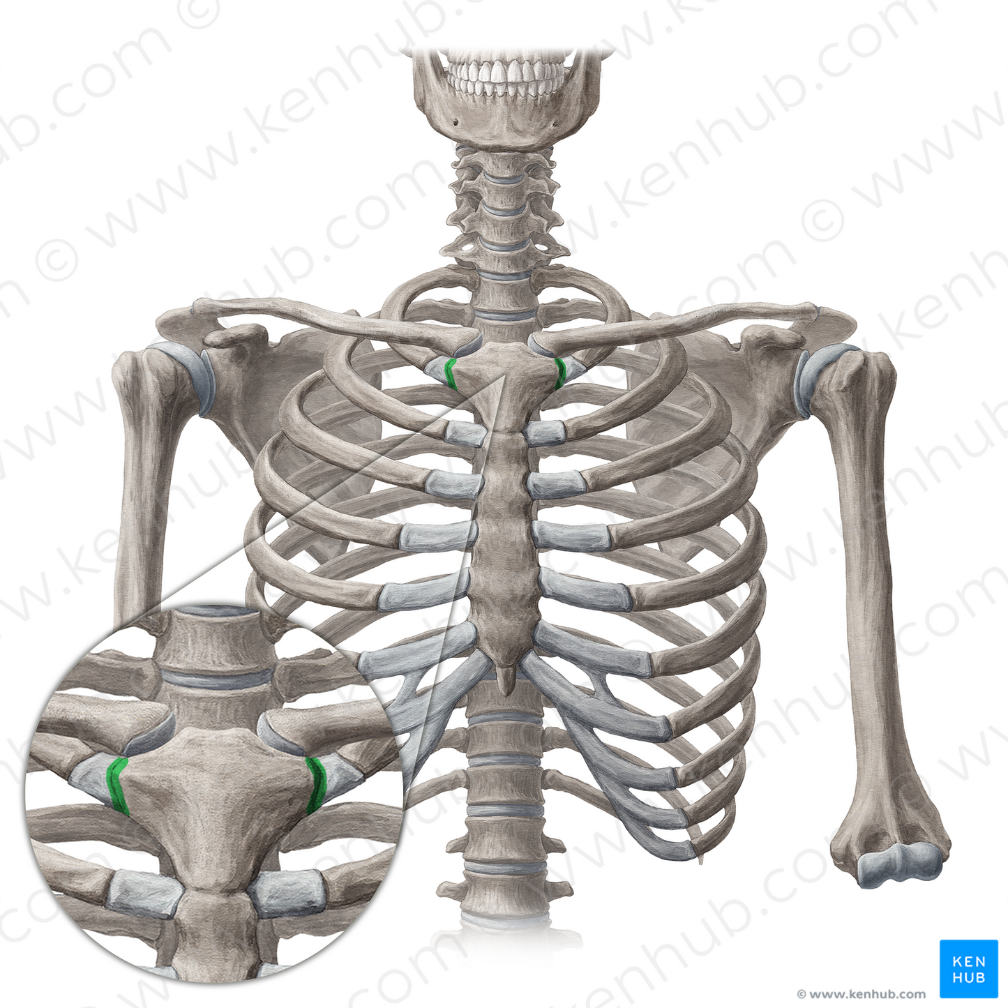 Sternochondral synchondrosis of 1st rib (#18815)