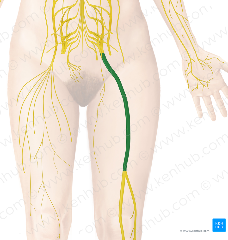 Sciatic nerve (#6497)