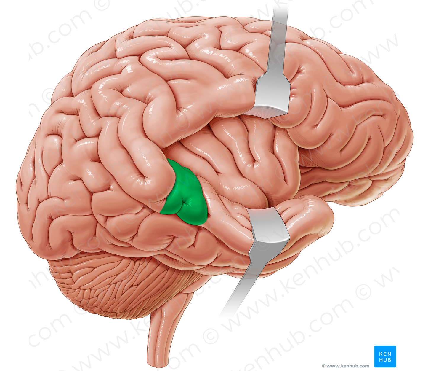 Transverse temporal gyri (#21189)