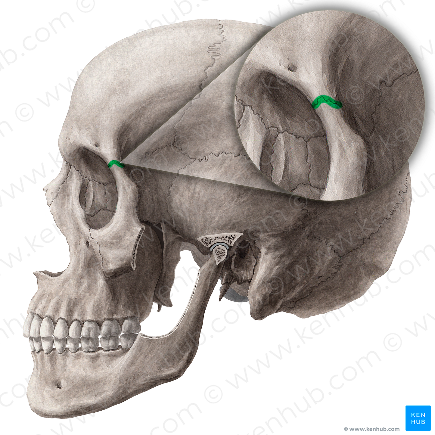 Frontozygomatic suture (#21453)