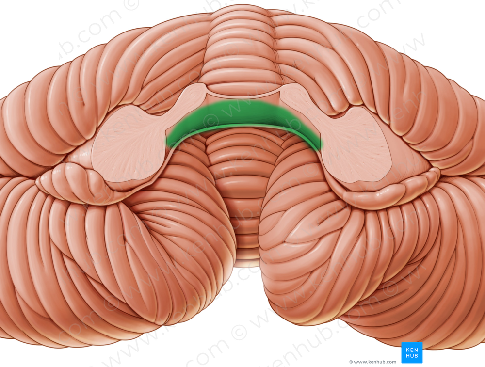 Fourth ventricle (#10720)