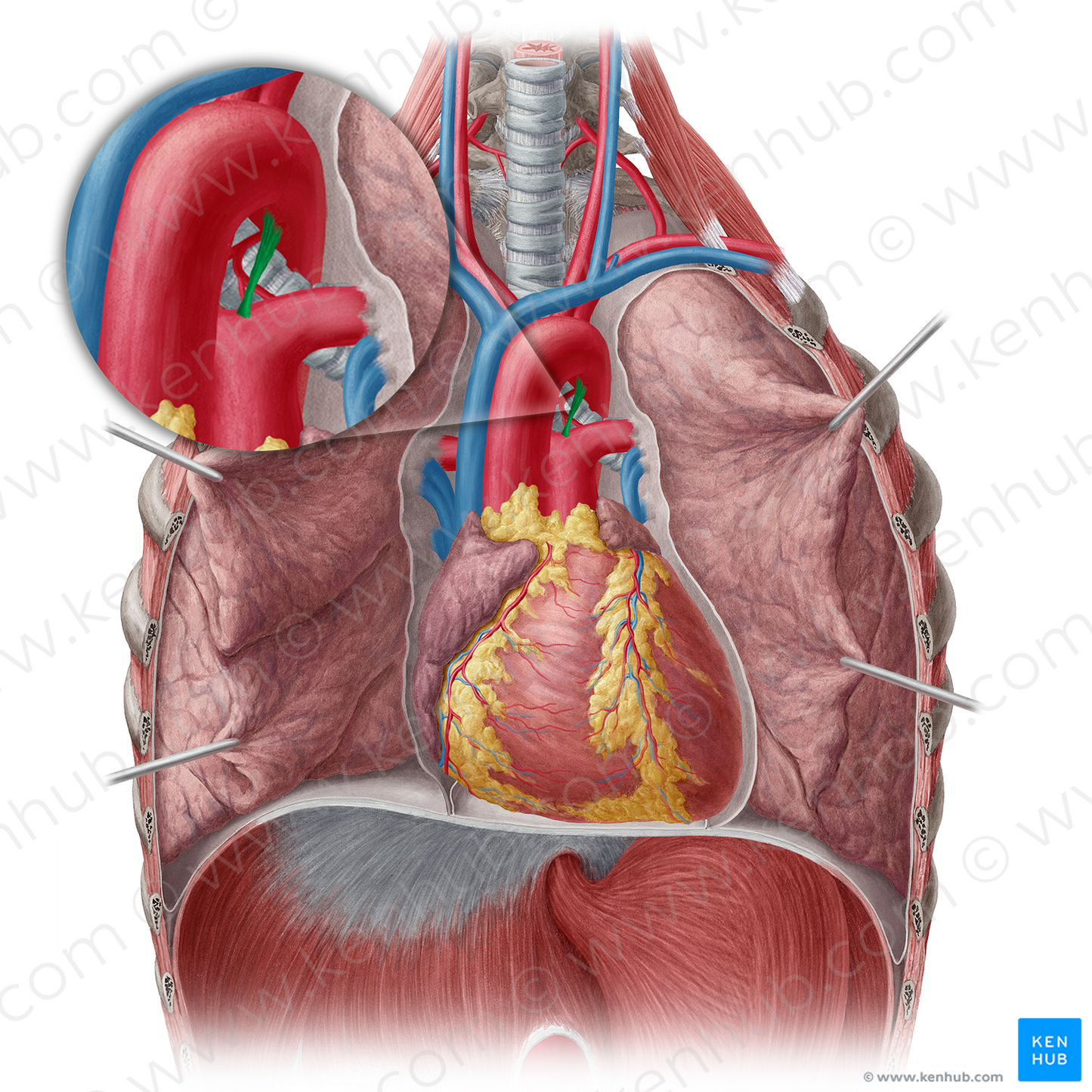 Ligamentum arteriosum (#4473)