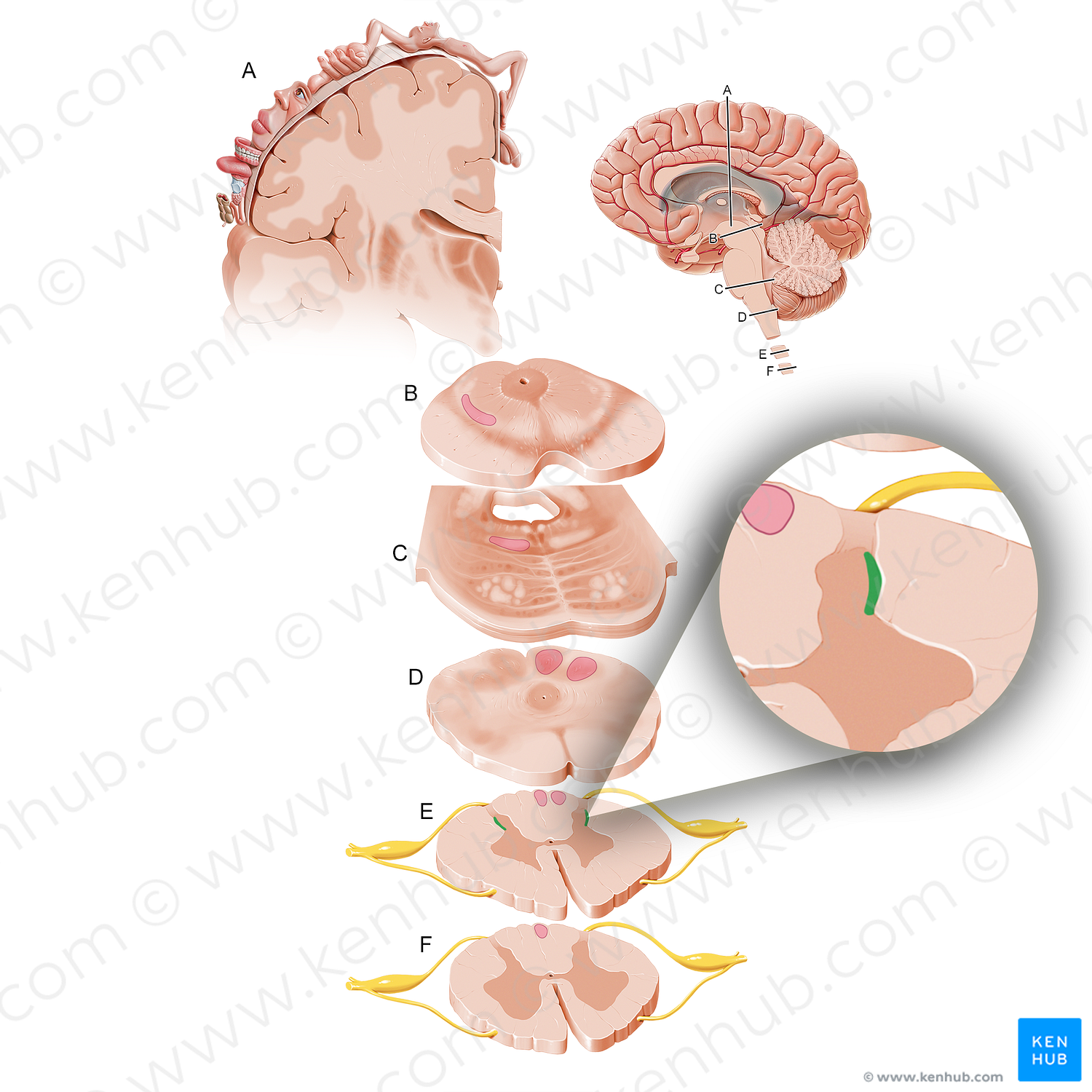 Lateral cervical nucleus (#12091)