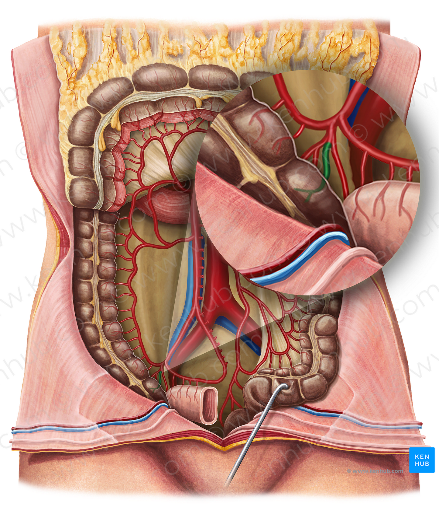 Anterior cecal artery (#915)