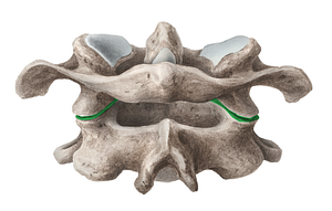 Lateral atlantoaxial joint (#2001)