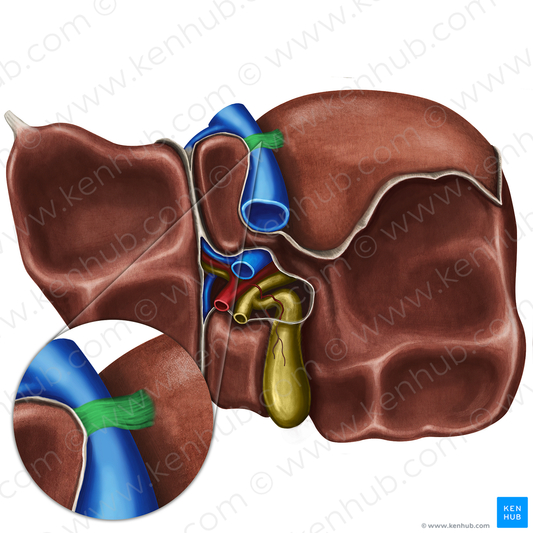 Ligament of inferior vena cava (#4675)