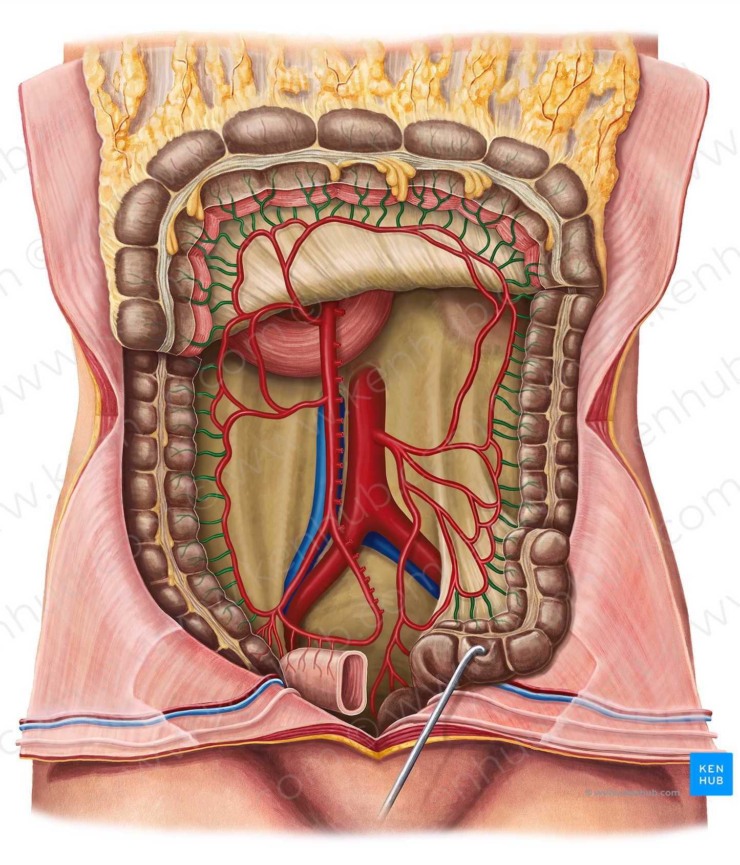Straight arteries of colon (#1204)
