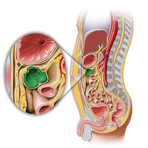 Transverse colon (#2763)