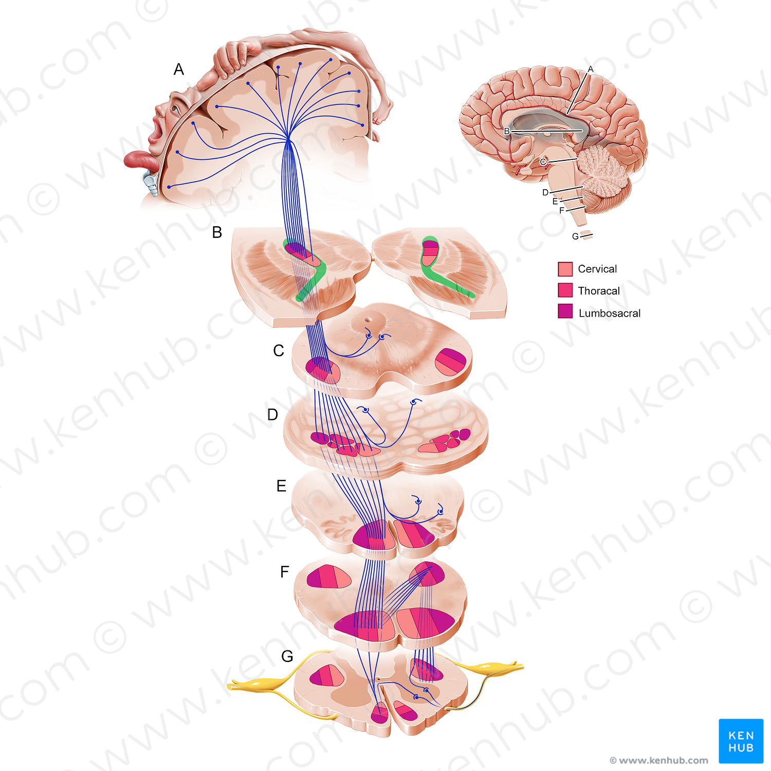 Internal capsule (#11211)