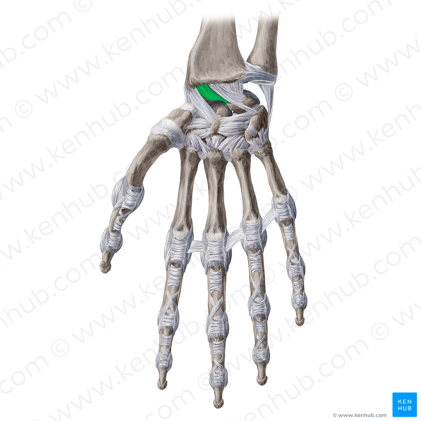 Radioscapholunate ligament (#20658)