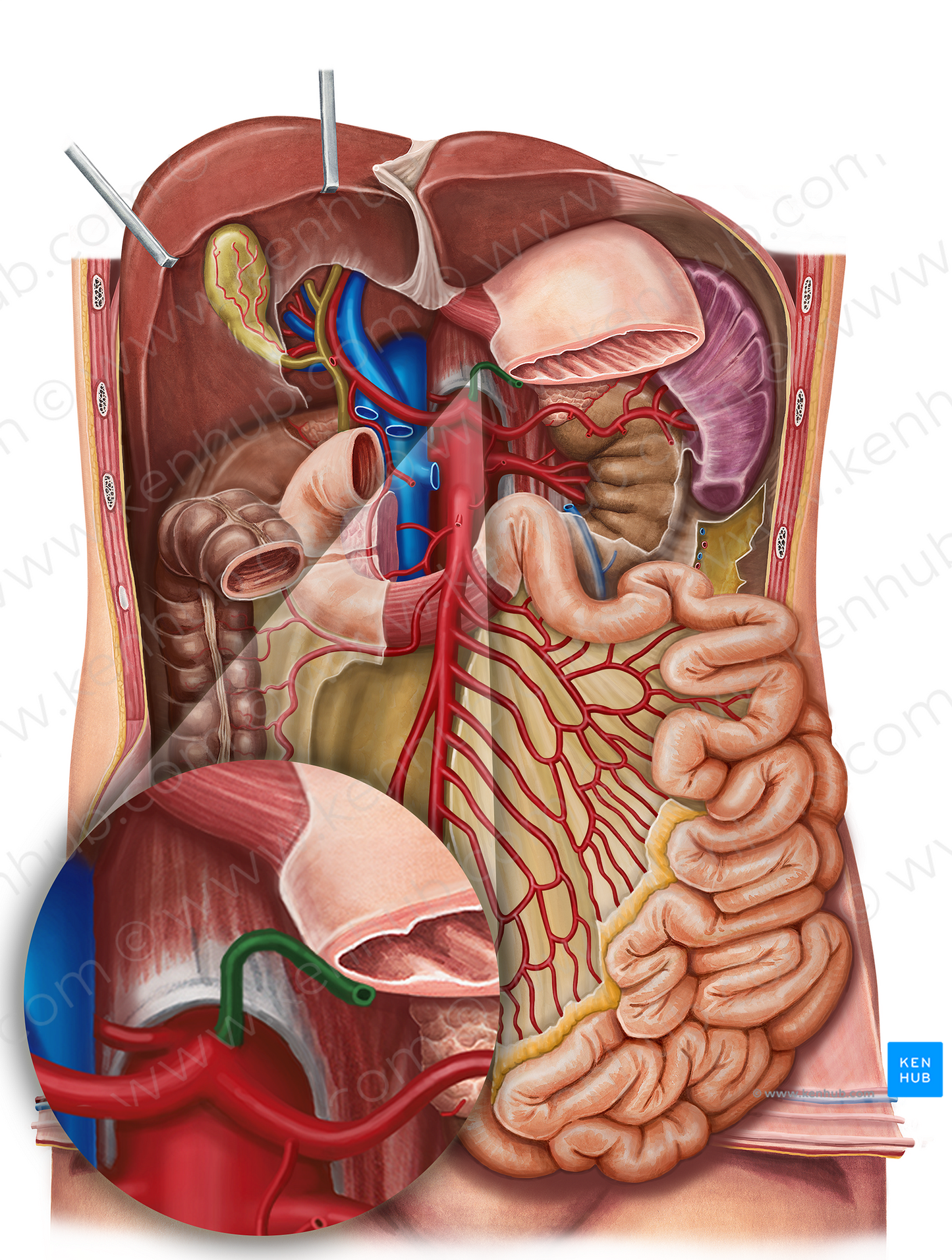 Left gastric artery (#1276)