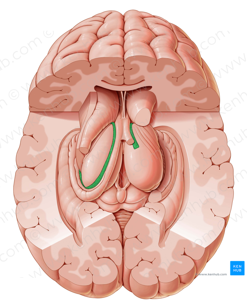Choroid plexus of lateral ventricle (#7979)