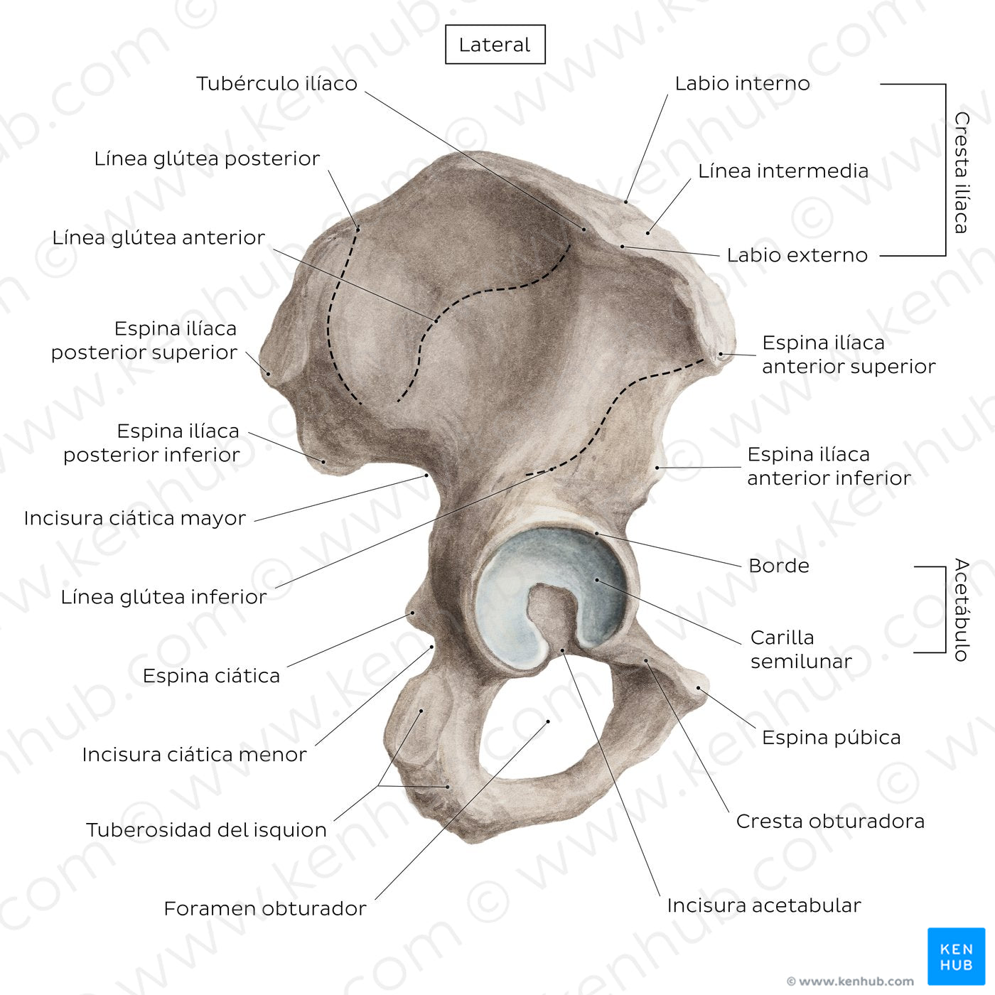 Hip bone (lateral view) (Spanish)