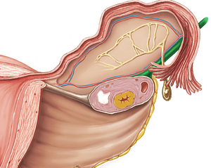 Suspensory ligament of ovary (#4624)