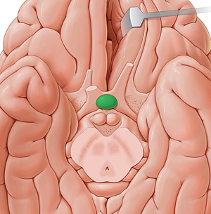 Pituitary gland (#4100)