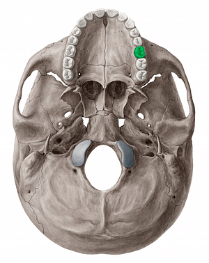 Maxillary left first molar tooth (#12839)