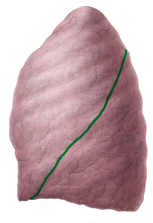 Oblique fissure of left lung (#3671)